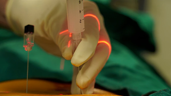 تزریق دیسکوژل توسط دکتر سید مسعود هاشمی با بیش از 20 سال سابقه